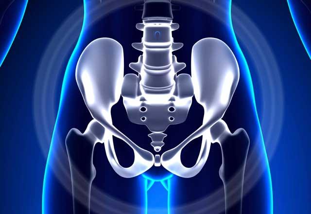 Illustration of pelvic bone xray
